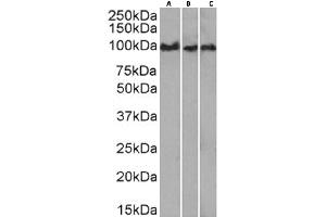 Western Blot using anti-CD43 antibody 84-3C. (Recombinant CD43 抗体)