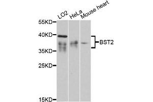 Western blot analysis of extracts of various cell lines, using BST2 antibody (ABIN5997320) at 1:3000 dilution. (BST2 抗体)