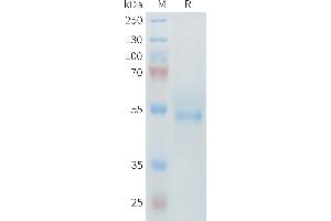 Mouse Protein, His Tag on SDS-PAGE under reducing condition. (ROR2 Protein (AA 34-403) (His tag))