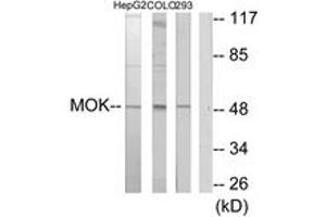 Western blot analysis of extracts from HepG2/COLO205/293 cells, using MOK Antibody. (MOK 抗体  (AA 261-310))