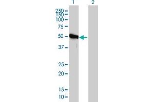 Western Blotting (WB) image for anti-Phosphoribosylglycinamide Formyltransferase (GART) (AA 1-433) antibody (ABIN560998)