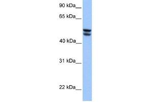 WB Suggested Anti-OXCT1 Antibody Titration:  0. (OXCT1 抗体  (Middle Region))
