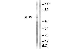 Western Blotting (WB) image for anti-CD19 Molecule (CD19) (Tyr531) antibody (ABIN1847935) (CD19 抗体  (Tyr531))