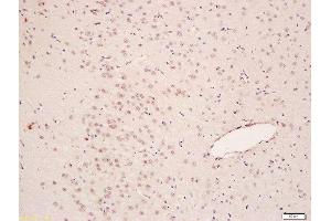 Formalin-fixed and paraffin embedded rat brain labeled with Anti-pan methyl Lysine Polyclonal Antibody, Unconjugated  at 1:200 followed by conjugation to the secondary antibody and DAB staining (Methylated Lysine (methylated) 抗体)