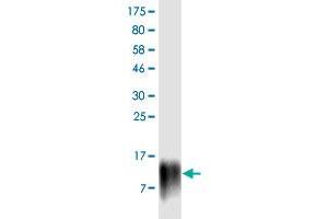 Western Blot detection against Immunogen (13. (PDCD1LG2 抗体  (AA 19-121))