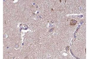 ABIN6268757 at 1/100 staining human brain tissue sections by IHC-P. (FBLN4 抗体  (Internal Region))