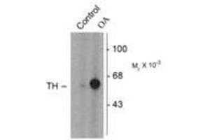 Image no. 1 for anti-Tyrosine Hydroxylase (TH) (pSer31) antibody (ABIN227933) (Tyrosine Hydroxylase 抗体  (pSer31))