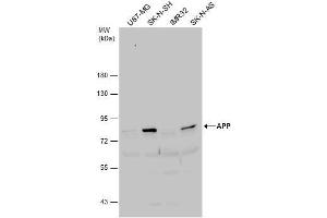 Western Blotting (WB) image for anti-Amyloid beta (A4) Precursor Protein (APP) (C-Term) antibody (ABIN2855011)