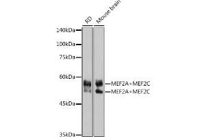 Western blot analysis of extracts of various cell lines, using MEF2A+MEF2C antibody (ABIN1679049, ABIN1679050, ABIN7101495 and ABIN7101496) at 1:1000 dilution. (MEF2A+MEF2C 抗体)