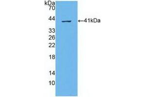 Detection of Recombinant ABCA4, Human using Polyclonal Antibody to ATP Binding Cassette Transporter A4 (ABCA4) (ABCA4 抗体  (AA 1398-1727))