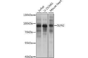 SUN2 抗体