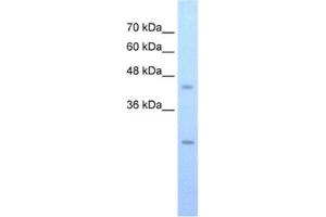 Western Blotting (WB) image for anti-FLJ20489 antibody (ABIN2462594) (FLJ20489 抗体)