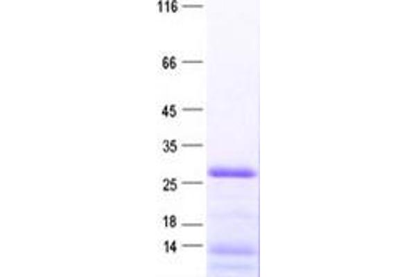 RPL10A Protein (full length) (His tag)