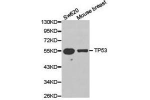 Western Blotting (WB) image for anti-Tumor Protein P53 (TP53) antibody (ABIN1875168) (p53 抗体)