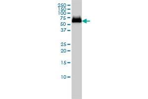 Western Blotting (WB) image for anti-Glucosidase, Beta, Acid (GBA) (AA 146-235) antibody (ABIN561009)