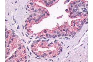 Immunohistochemical staining of Prostate (Epithelium) using anti- GPR87 antibody ABIN122192 (GPR87 抗体  (N-Term))