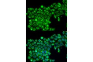 Immunofluorescence analysis of MCF7 cell using TNFSF13 antibody. (TNFSF13 抗体)