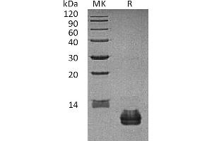 Greater than 95 % as determined by reducing SDS-PAGE. (CCL27 蛋白)