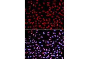 Immunofluorescence analysis of U2OS cells using POLH antibody (ABIN5970934). (POLH 抗体)
