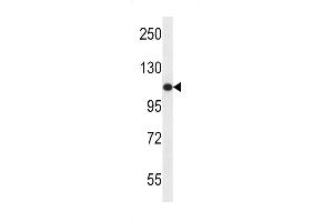 Western blot analysis in ZR-75-1 cell line lysates (35ug/lane). (USO1 抗体  (C-Term))