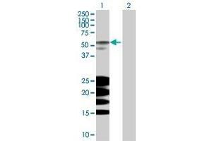 Lane 1: BPIL1 transfected lysate ( 49. (BPIL1 293T Cell Transient Overexpression Lysate(Denatured))