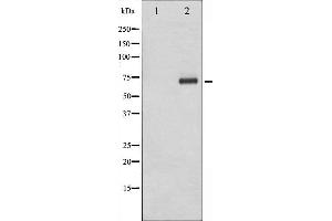 Western blot analysis of p70 S6 Kinase phosphorylation expression in Jurkat whole cell lysates,The lane on the left is treated with the antigen-specific peptide. (RPS6KB1 抗体  (pThr229))