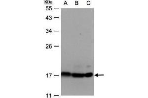 WB Image Sample(30 ug whole cell lysate) A:Hep G2, B:MOLT4, C:Raji, 12% SDS PAGE antibody diluted at 1:500 (ATP Synthase delta (Center) 抗体)