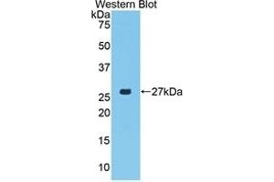 Detection of Recombinant CTGF, Porcine using Polyclonal Antibody to Connective Tissue Growth Factor (CTGF) (CTGF 抗体  (AA 101-330))