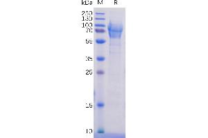 SELPLG Protein (AA 18-320) (His tag)