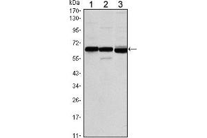 Western blot analysis using ESR1 mouse mAb against MCF-7 (1), T47D (2) and SKBR3 (3) cell lysate. (Estrogen Receptor alpha 抗体)