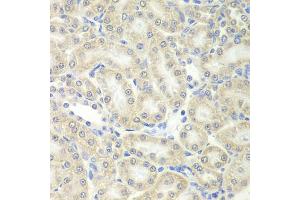 Immunohistochemistry of paraffin-embedded mouse kidney using PRDX5 antibody (ABIN5973743) at dilution of 1/200 (40x lens). (Peroxiredoxin 5 抗体)