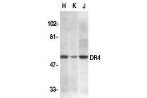 Western Blotting (WB) image for anti-Tumor Necrosis Factor Receptor Superfamily, Member 10a (TNFRSF10A) (N-Term) antibody (ABIN2479548) (TNFRSF10A 抗体  (N-Term))