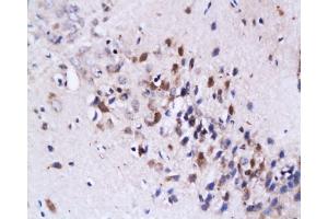 Immunohistochemistry (Paraffin-embedded Sections) (IHC (p)) image for anti-Fas Ligand (TNF Superfamily, Member 6) (FASL) (AA 196-281) antibody (ABIN726410)