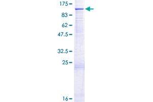 Image no. 1 for Cullin 1 (CUL1) (AA 1-776) protein (GST tag) (ABIN1350756) (Cullin 1 Protein (CUL1) (AA 1-776) (GST tag))