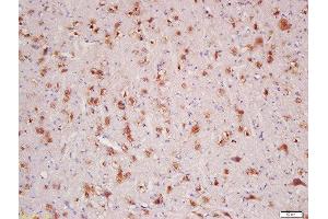 Formalin-fixed and paraffin embedded rat brain labeled with Rabbit Anti-HER4/ErbB4 Polyclonal Antibody, Unconjugated  at 1:200 followed by conjugation to the secondary antibody and DAB staining (ERBB4 抗体  (AA 451-550))