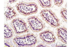 Immunohistochemistry (Paraffin-embedded Sections) (IHC (p)) image for anti-S100 Calcium Binding Protein A4 (S100A4) (AA 15-101) antibody (ABIN703706)