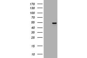 Image no. 1 for anti-Vimentin (VIM) antibody (ABIN1501717) (Vimentin 抗体)