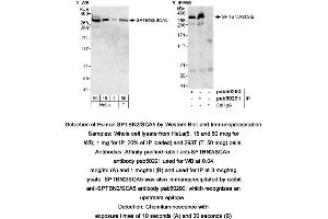 Image no. 1 for anti-Spectrin, Beta, Non-erythrocytic 2 (SPTBN2) (AA 2300-2390), (C-Term) antibody (ABIN363600) (Spectrin, Beta, Non-erythrocytic 2 (SPTBN2) (AA 2300-2390), (C-Term) 抗体)