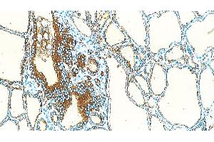 Human Thyriod: immunohistochemical staining of Thyroglobulin in the follicular epithelial cells. (Thyroglobulin 抗体)