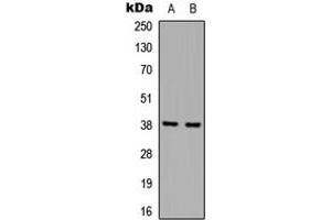 Western blot analysis of hnRNP D0 expression in A431 (A), Jurkat (B) whole cell lysates. (HNRNPD/AUF1 抗体  (Center))
