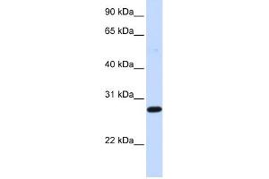 DCK antibody used at 1 ug/ml to detect target protein. (DCK 抗体  (Middle Region))
