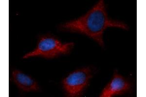 Immunofluorescence (IF) image for anti-Coagulation Factor III (thromboplastin, Tissue Factor) (F3) antibody (APC) (ABIN5567677) (Tissue factor 抗体  (APC))