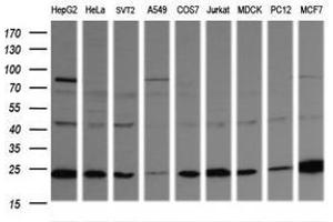 Image no. 5 for anti-RAB21, Member RAS Oncogene Family (RAB21) antibody (ABIN1500542) (RAB21 抗体)
