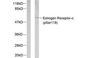 Western blot analysis of extracts from MCF7 cells treated with Estradiol, using Estrogen Receptor-alpha (Phospho-Ser118) Antibody. (Estrogen Receptor alpha 抗体  (pSer118))