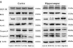 Western Blotting (WB) image for anti-Glucagon-Like Peptide 1 Receptor (GLP1R) (AA 101-200) antibody (ABIN731333)