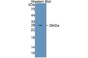 Detection of Recombinant Smad2, Human using Polyclonal Antibody to Mothers Against Decapentaplegic Homolog 2 (Smad2) (SMAD2 抗体  (AA 274-467))