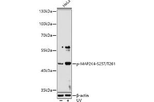 Western blot analysis of extracts of HeLa cells, using Phospho-MK4-S257/T261 antibody (ABIN6135256, ABIN6136136, ABIN6136137 and ABIN6225569) at 1:1000 dilution. (MAP2K4 抗体  (pSer257, pThr261))