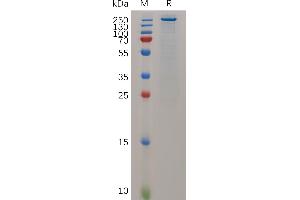 Mouse T Protein, His Tag on SDS-PAGE under reducing condition. (TENM4 Protein (AA 367-2771) (His tag))