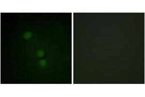 Immunofluorescence analysis of HeLa cells, using Histone H2B (Acetyl-Lys15) Antibody. (Histone H2B 抗体  (acLys15))