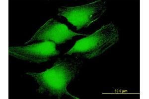 Immunofluorescence of purified MaxPab antibody to TP53 on HeLa cell. (p53 抗体  (AA 1-393))